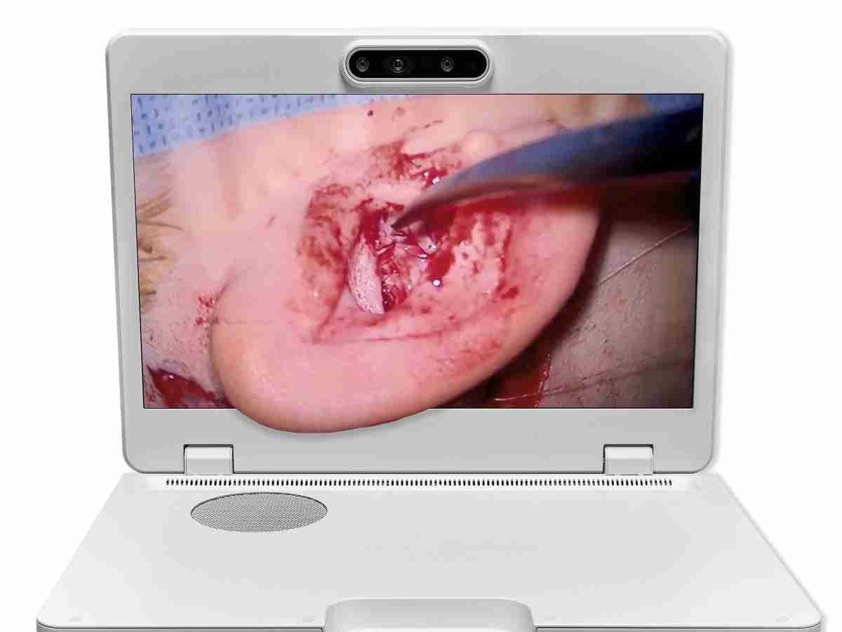 达擎之＂Heads-up 3D显微手术显示系统＂，，，整合4K裸眼3D显示及眼球追踪系统，，，具备快速追踪人眼移动位置功能，，减轻医师长时间维持固定姿势的负担，，让医师能有更宽广清晰的3D立体视野及更舒适的姿势来执行手术。。。